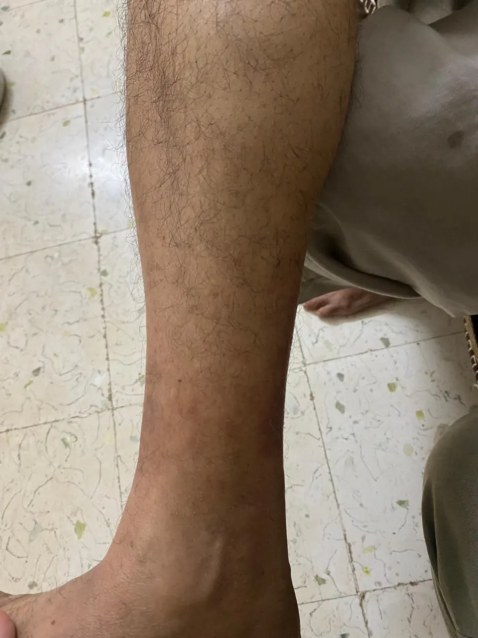 Before treatment - patient with skin condition