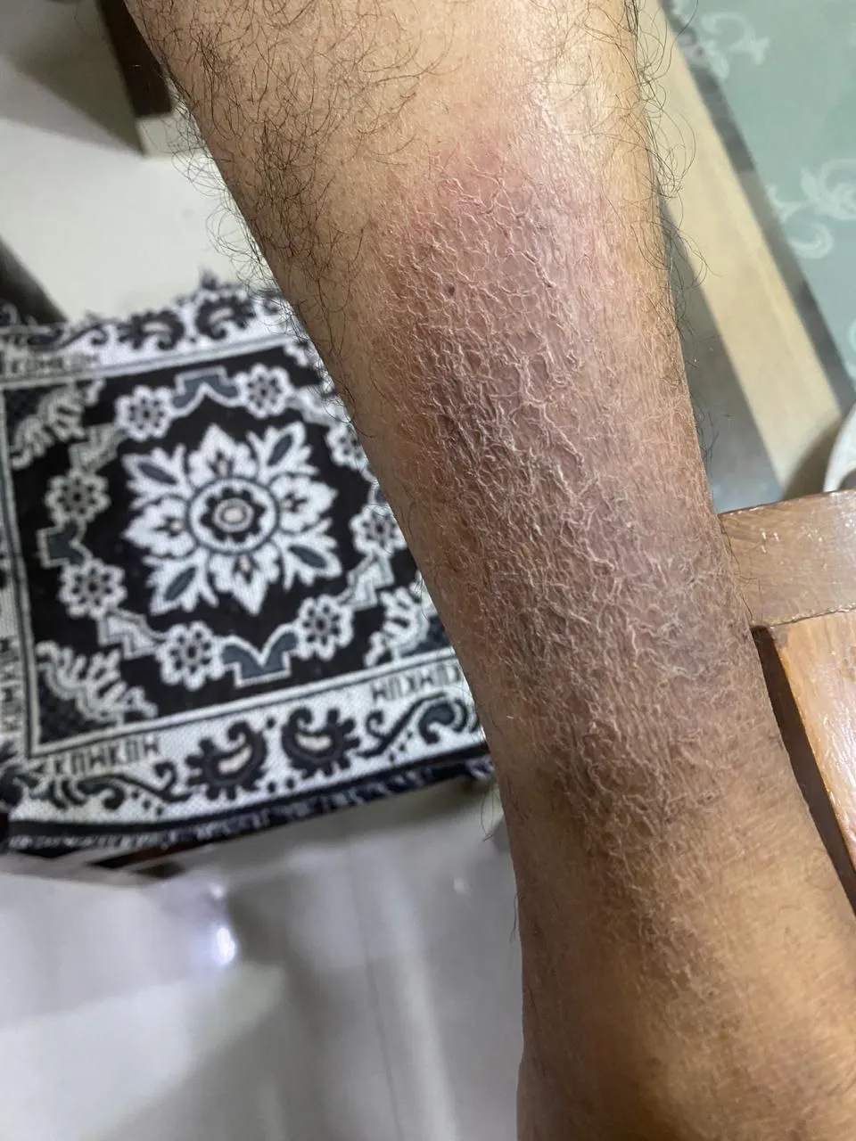 After treatment - patient after homeopathy