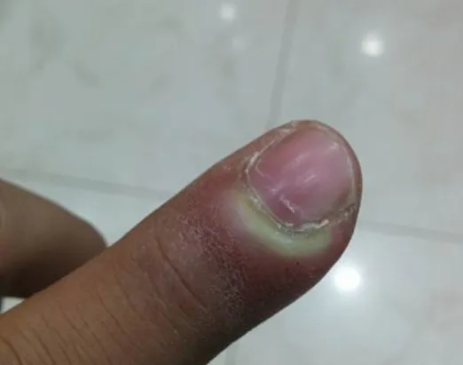 After treatment - patient after homeopathy