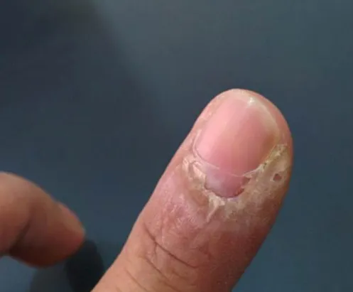 Before treatment - patient with skin condition