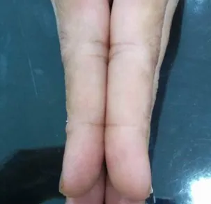 Before treatment - patient with skin condition